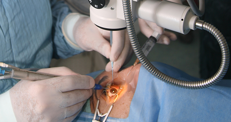 cataracte-chirurgie